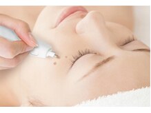 低周波シミケアおすすめです♪