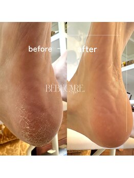 ゼロハチイチ(081)の写真/1回で実感する、フワフワ足裏体験◇BEBE CARE Spa