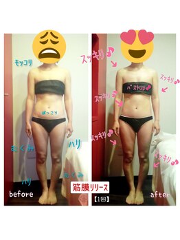 ビューティサロン キヨの部屋(beauty salon)/【筋膜リリース】 １回　