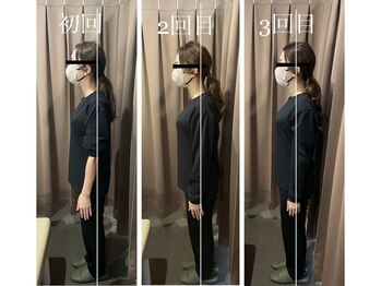 アイリー(Irie)/骨格矯正