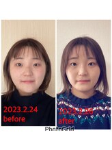 ノウ(nou)/小顔矯正／ヘッドスパ