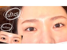 ベロニカ(Beronica)/大人気ラッシュリフト