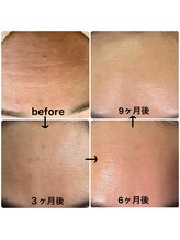 ルームエイトエイティスリー 新宿(R883)/シワたるみほうれい線改善コース