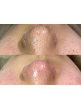 お肌をきれいにしたい