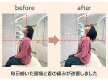 フィクシブ 上野(FIXIBE)/目の向きに注目！