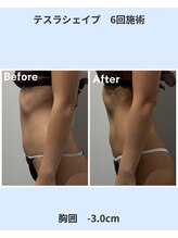 アーヒル 富山店(A”-HILU)/