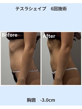 アーヒル 富山店(A”-HILU)/