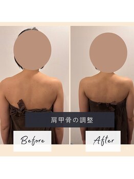 ソロウノ 平和島本院/天使の羽調整