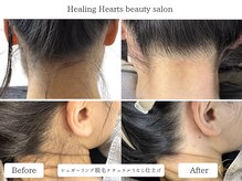 ヒーリングハーツ(Healing Hearts)