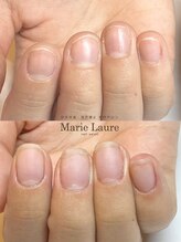 マリーロール 梅田店(Marie Laure)/自爪育成/深爪矯正/ネイルケア