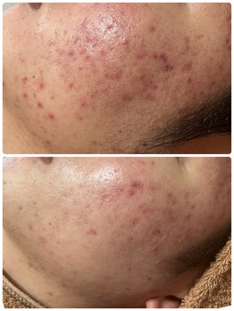 リノ(Lino)/男性で悩んでる方必見!