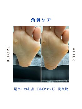 ピーアンドオー(P&O)/