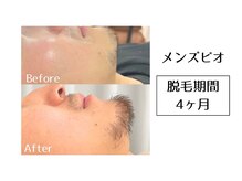 メンズビオ 神戸三宮店/