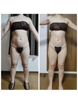 スリール(sourire)/ビフォーアフター