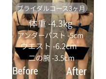 オーパス ビューティー(OPUS Beauty)の雰囲気(人気の【ブライダルコース】3ヶ月での結果です。)