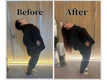 整体ラルース 中目黒(LALUZ)/20代　女性　腰痛、姿勢改善