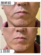 サロンモコ(Salon Moco)/