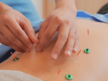 リターズ鍼灸治療所 天王寺院の写真/【天王寺駅徒歩2分!完全個室の鍼灸マッサージ院】新しい出会いを、あなたに。