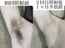 テンパ ビューティー(+10%beauty)/効果写真