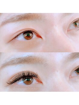 アイクイーン 亀戸(Eyequeen)/