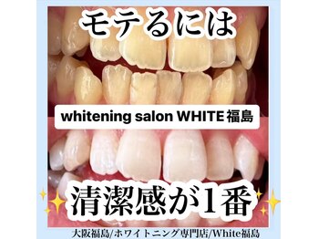 ホワイトニングサロン ホワイト(WHITE)/セルフホワイトニング/大阪/福島