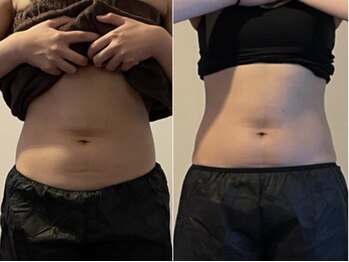 しあわせ腸研究所の写真/美くびれを手に入れる!腸セラピーで内側から健康的に!お腹・腰回りのお肉を撃退してくびれ美人♪