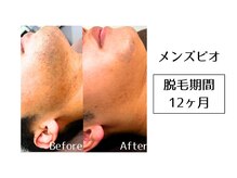 メンズビオ 神戸三宮店/