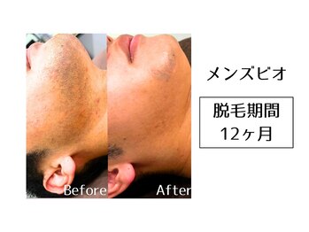 メンズビオ 神戸三宮店/