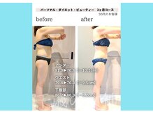 千歳の女神 岡崎店/【施術風景】Before/After