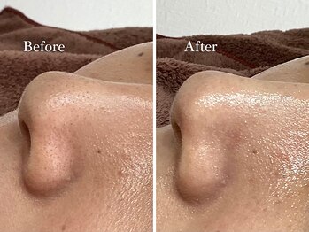 エリー(Ellie)/少しの変化でも大きな変化