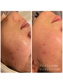 エクラ(eclat)/クリスティーナ