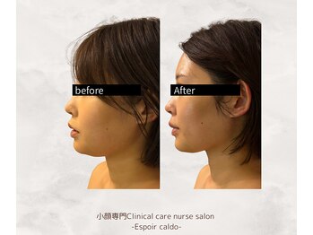 エスポワールカルド(Espoir caldo)/