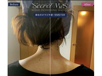 ユフラ(Juhla)/首肩集中デトックス