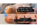 高齢者の巻き爪こそ技術が重要!