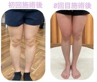 ミロクプラスアール(369+R)