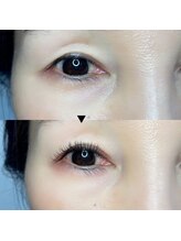 ミー(Me)/【10歳若々しく】