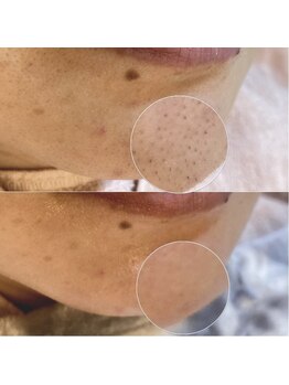 ルシェリア(Le cherien)/