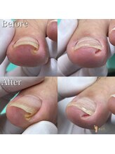 巻き爪補正店 那覇店/