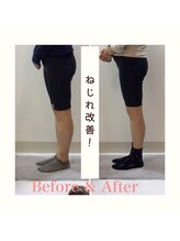 スタイルラボ高松/産後骨盤矯正の効果♪