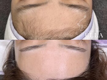 エラ(ELLA)の写真/【美肌フェイシャルワックス(眉デザイン込)¥13,000】フェイシャルワックスで肌本来の明るさに!