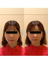 美骨ラボ 自由が丘(美骨Labo)/施術before＆after 