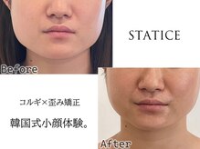 スターティス(STATICE)の雰囲気(結果重視◎ノアグロウ使用し肌の内側にダイレクトに届けます!)