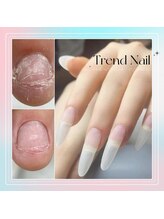 トレンドネイルスタジオ(Trend Nail Studio)/スカルプ施術によって、自爪補正