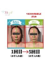 小顔整体研究所 KSラボ 新潟中山店/
