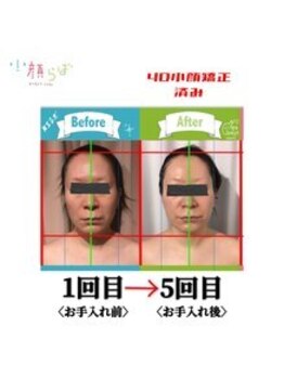 小顔整体研究所 KSラボ 新潟中山店/