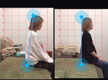 鈴木接骨院 青葉区小松島院/姿勢改善は当院へ！