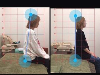 鈴木接骨院 青葉区小松島院/姿勢改善は当院へ！