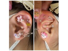 ビララ(美LALA)の雰囲気（耳ツボジュエリー）