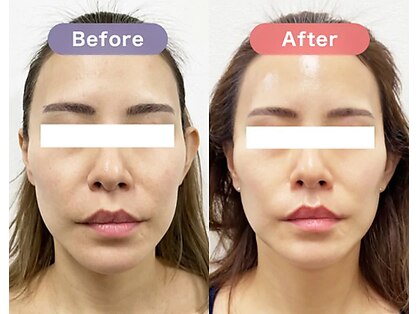 リラクゼーションサロン ラキ(laki)の写真