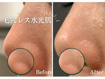 フジモトサロン 那覇おもろまち店(fujimotoサロン)/韓国肌管理/白玉肌/水光肌へ★